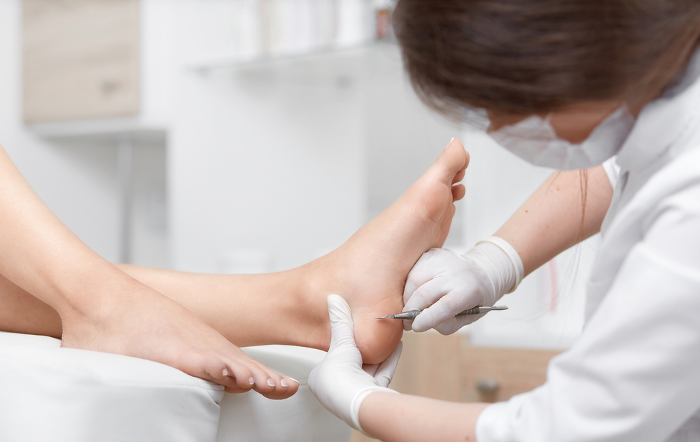 Corns and Callus