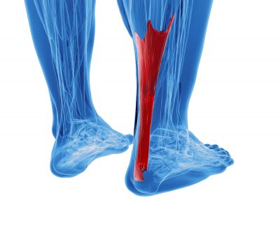 achilles tendonitis treatment