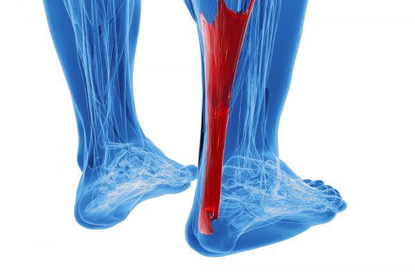 shutterstock_165117392 achilles tendonitis treatment