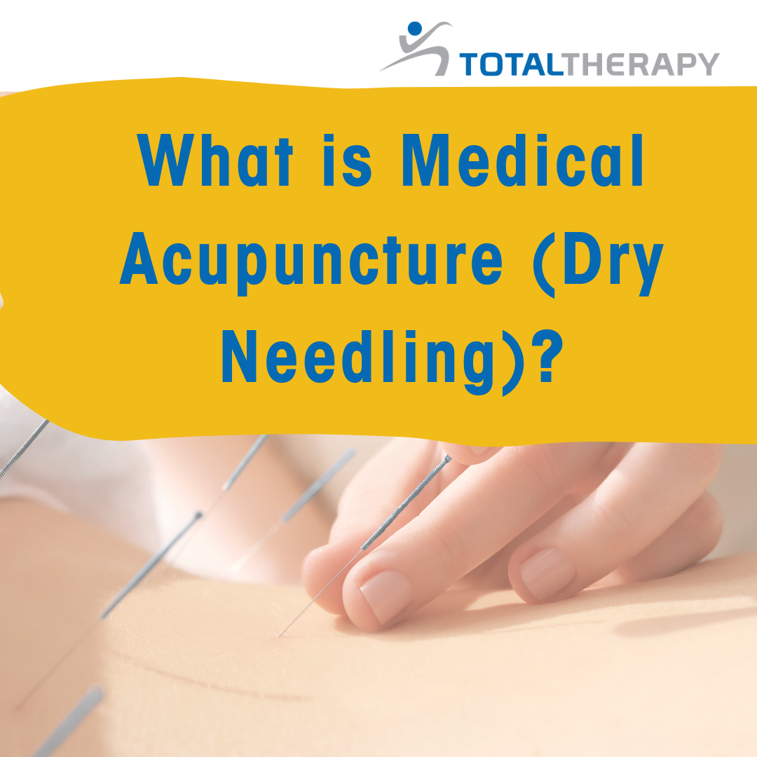 What is Medical Acupuncture?
